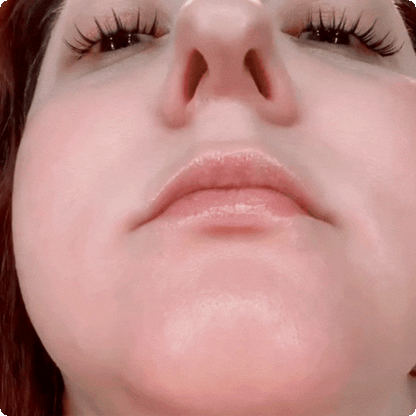 Tiras Magnéticas Nasal